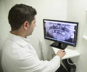 Czy prześwietlenie zębów jest bezpieczne? Czyli wszystko o rentgenie jamy ustnej!